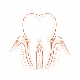 microcirugía periodontal — Centre Dental Basté