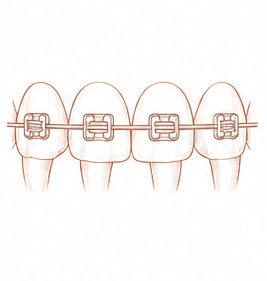 ortodoncia — Centre Dental Basté